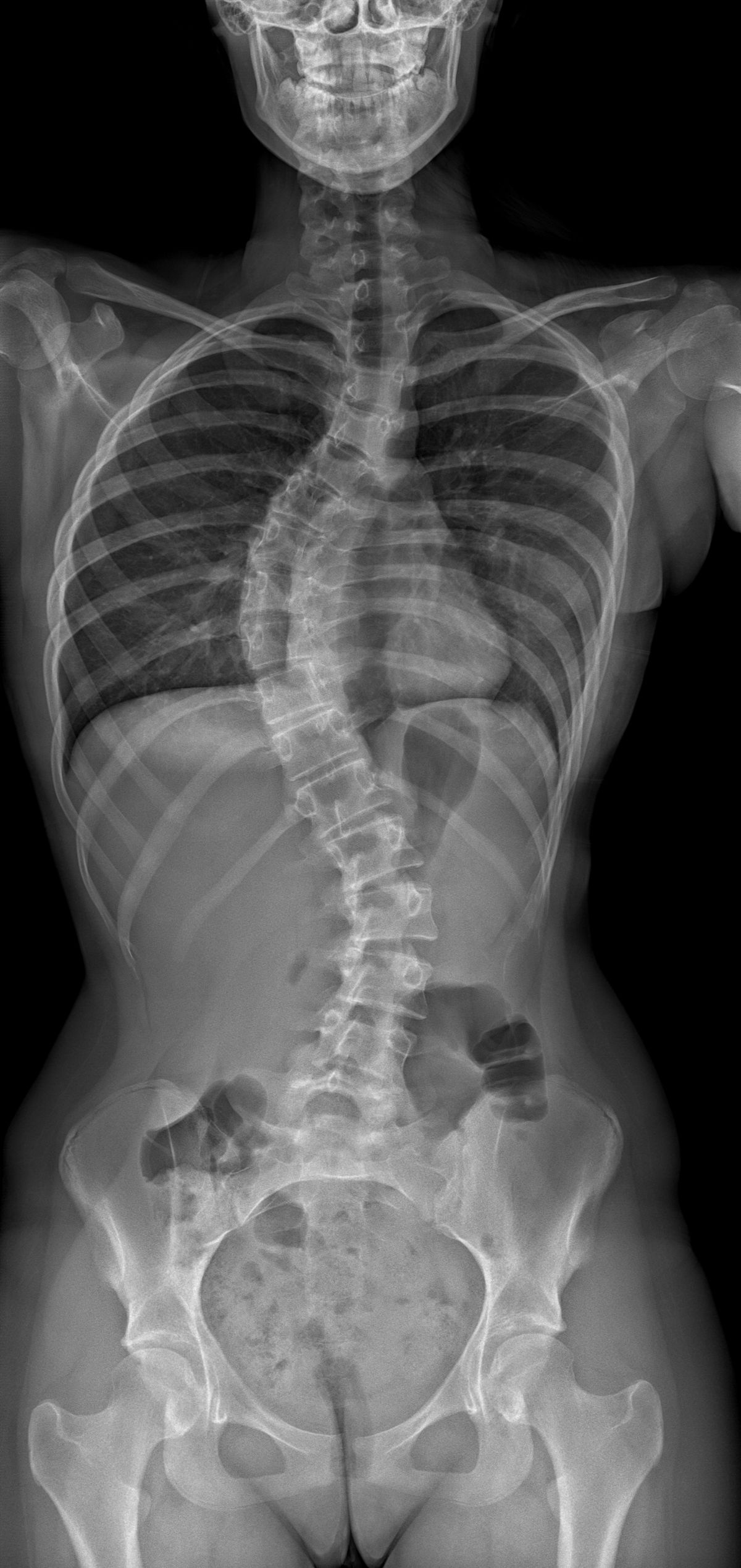 EOS Imagerie Jacquemars Gielée